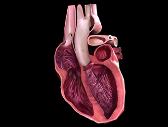 Cardiopulminary Heart Defects Animation